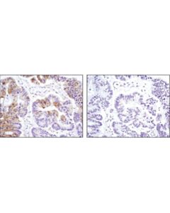 Cell Signaling Phospho-Erk1/2 Pathway Antibody Sampler Kit