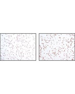 Cell Signaling Phospho-Sapk/Jnk Pathway Antibody Sampler Kit