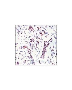 Cell Signaling Phospho-P38 Mapk Pathway Antibody Sampler Kit