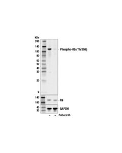 Cell Signaling Phospho-Rb (Thr356) Antibody