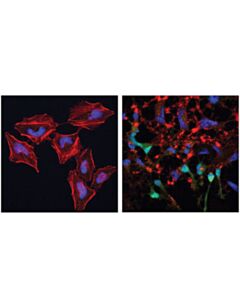 Cell Signaling Apoptosis Antibody Sampler Kit