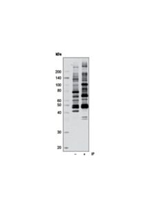 Cell Signaling Phospho-(Ser/Thr) Kinase Substrate Antibody Sampler Kit