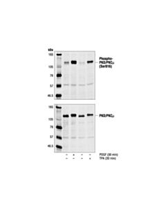 Cell Signaling Phospho-Pkc Antibody Sampler Kit