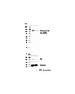 Cell Signaling Phospho-Rb (Ser807) Antibody