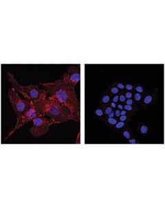 Cell Signaling N-Cadherin (D4r1h) Xp Rabbit mAb (Alexa Fluor 647 Conjugate)