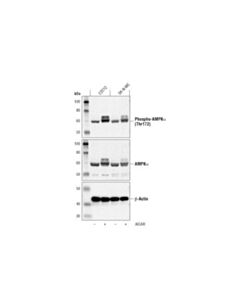Cell Signaling Aicar