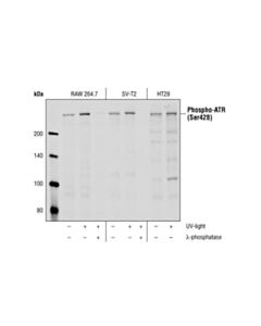 Cell Signaling Dna Damage Antibody Sampler Kit