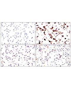 Cell Signaling Tigit (E5y1w) Xp<LT/>Sup&Gt;®<LT/>/Sup&Gt; Rabbit mAb