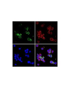 Cell Signaling Tigit (E5y1w) Xp<Lt/>Sup&Gt;®<Lt/>/Sup&Gt; Rabbit mAb