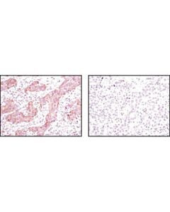 Cell Signaling Er Stress Antibody Sampler Kit