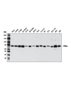 Cell Signaling Pkc Isoform Antibody Sampler Kit