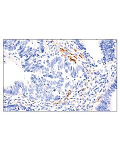 Cell Signaling Loxl2 (E3p7y) Rabbit mAb