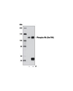 Cell Signaling Rb Antibody Sampler Kit