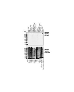 Cell Signaling Pdgf Receptor Beta Antibody Sampler Kit