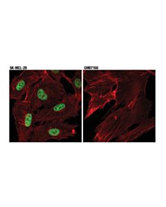 Cell Signaling Homologous Recombination (Hr) Dna Repair Antibody Sampler Kit