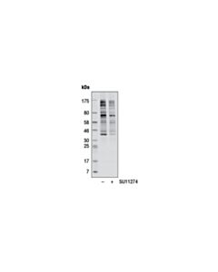 Cell Signaling Phospho-Akt Substrate (RXRXXS*/T*) (23C8D2) Rabbit mAb 20 uL