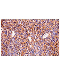 Cell Signaling CD81 (D5O2Q) Rabbit mAb 20 uL