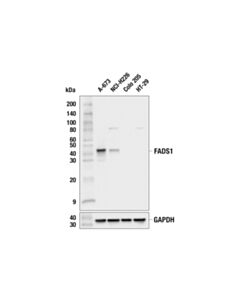 Cell Signaling FADS1 (F1D2A) Rabbit mAb 20 uL