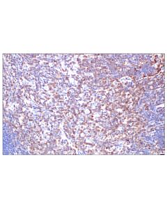 Cell Signaling Cd5 (E6n9s) Rabbit mAb