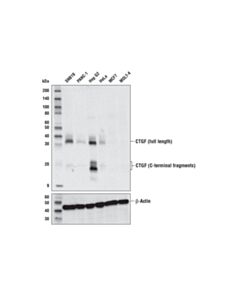 Cell Signaling Ctgf (E2w5m) Rabbit mAb