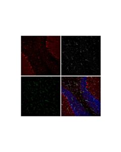 Cell Signaling S100B (E7C3A) Mouse Chimeric mAb