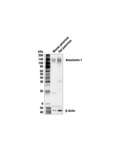 Cell Signaling DOG1/Anoctamin 1 (F9W4N) Rabbit mAb 100 uL
