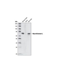 Cell Signaling Neurofilament-L (C28e10) Rabbit mAb (BSA And Azide Free)