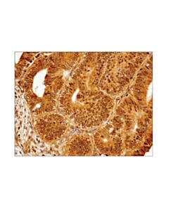 Cell Signaling IRF-3 (D9J5Q) Mouse mAb 20 uL