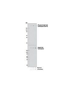 Cell Signaling Phospho-Acetyl-Coa Carboxylase (Ser79) (D7d11) Rabbit mAb