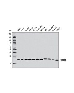 Cell Signaling UBE2S (D5H9H) Rabbit mAb 20 uL