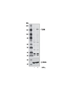 Cell Signaling Toll-like Receptor 8 (D3Z6J) Rabbit mAb 20 uL