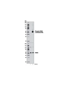 Cell Signaling Phospho-Irak4 (Thr345/Ser346) (D6d7) Rabbit mAb