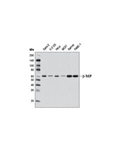 Cell Signaling Beta-Trcp (D12c8) Rabbit mAb