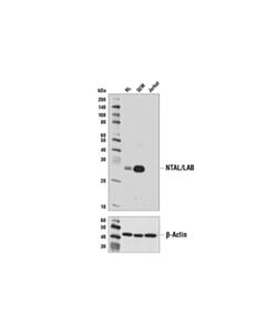 Cell Signaling Ntal/Lab (D7i2b) Rabbit mAb