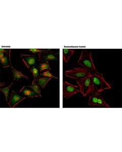 Cell Signaling Glucocorticoid Receptor (D8h2) Xp Rabbit mAb (Alexa Fluor 488 Conjugate)