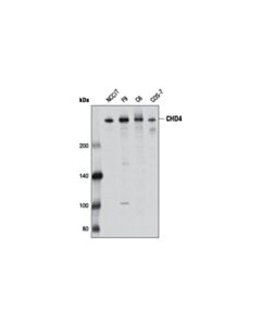 Cell Signaling CHD4 (D4B7) Rabbit mAb 20 uL