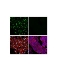 Cell Signaling Glucocorticoid Receptor (D6h2l) Xp Rabbit mAb