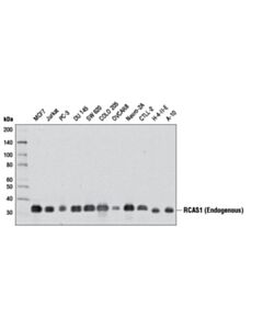 Cell Signaling Rcas1 (D6p5j) Rabbit mAb