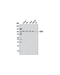 Cell Signaling ITCH (D8Q6D) Rabbit mAb 20 uL