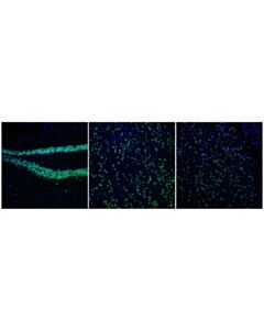 Cell Signaling Bcl-11b (D6f1) Xp Rabbit mAb