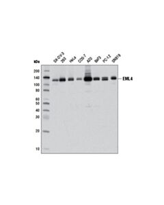 Cell Signaling EML4 (D7Y8F) XP Rabbit mAb 20 uL