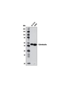 Cell Signaling Calreticulin (D3e6) Xp Rabbit mAb