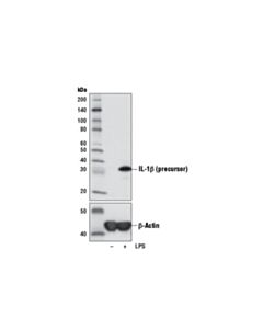 Cell Signaling Il-1beta (3a6) Mouse mAb
