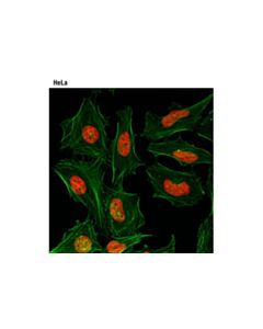 Cell Signaling Di-Methyl-Histone H3 (Lys27) (D18c8) Xp  Rabbit mAb (Alexa Fluor  647 Conjugate)