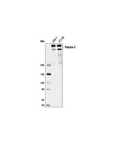 Cell Signaling Plectin-1 (D6a11) Rabbit mAb