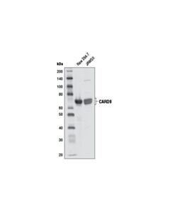 Cell Signaling Card9 Antibody (Mouse Preferred)