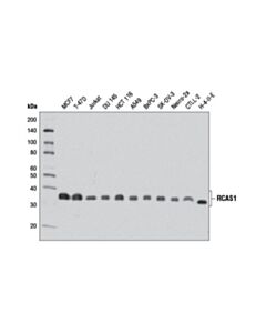 Cell Signaling Rcas1 (D2b6n) Xp Rabbit mAb