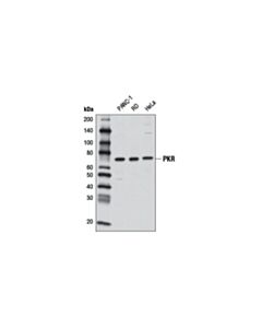 Cell Signaling Pkr (D7f7) Rabbit mAb