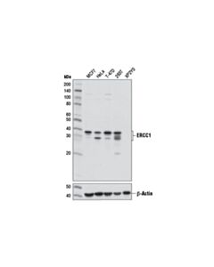 Cell Signaling Ercc1 (D6g6) Xp Rabbit mAb