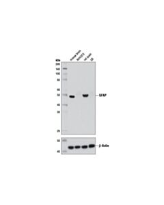 Cell Signaling Gfap (D1f4q) Xp Rabbit mAb